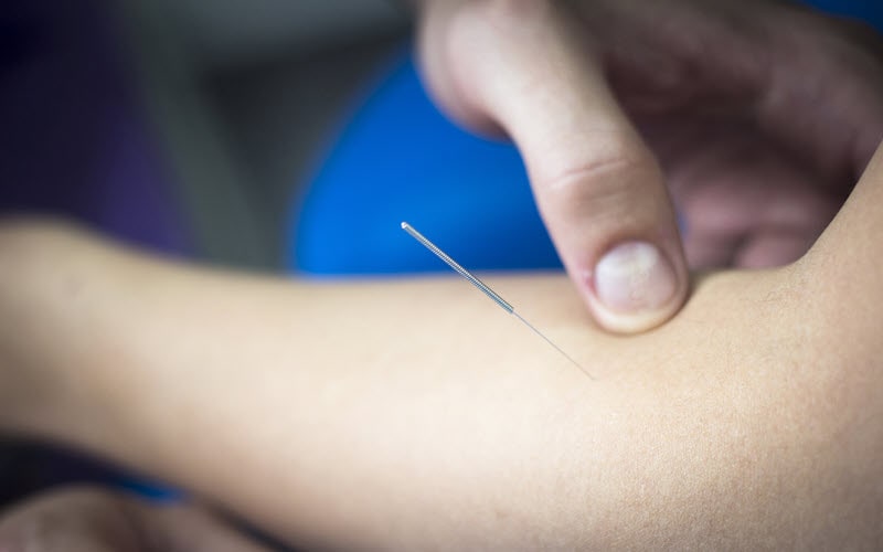 Dry needling osteopathy services in Booragoon, Western Australia.